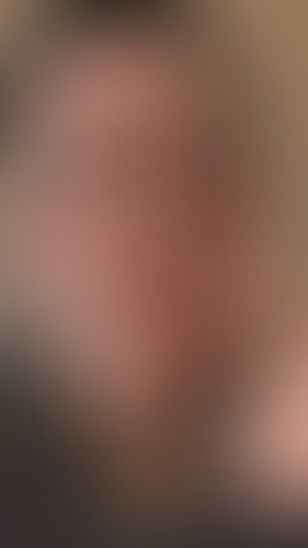 Geblurrte Content-Vorschau