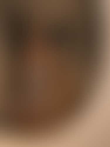 Geblurrte Content-Vorschau