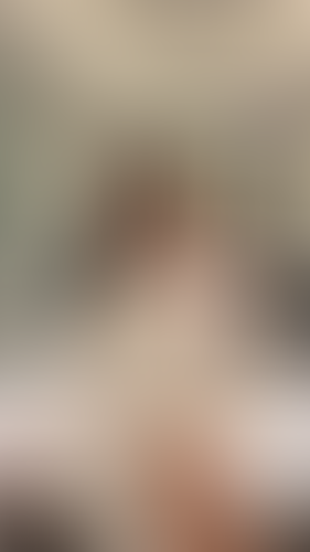 Geblurrte Content-Vorschau