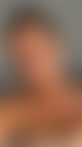 Geblurrte Content-Vorschau