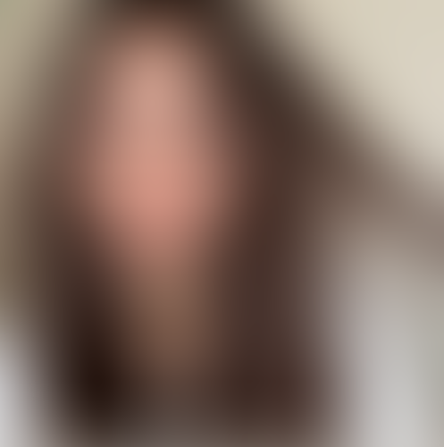 Geblurrte Content-Vorschau