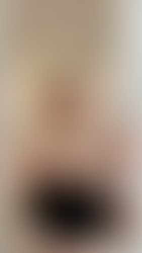 Geblurrte Content-Vorschau