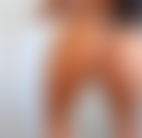 Geblurrte Content-Vorschau