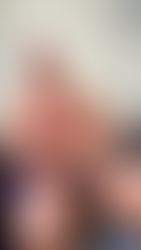 Geblurrte Content-Vorschau