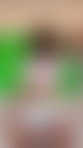 Geblurrte Content-Vorschau