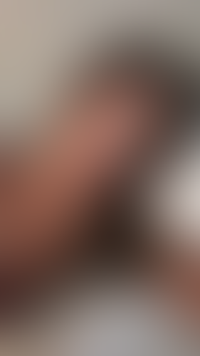 Geblurrte Content-Vorschau