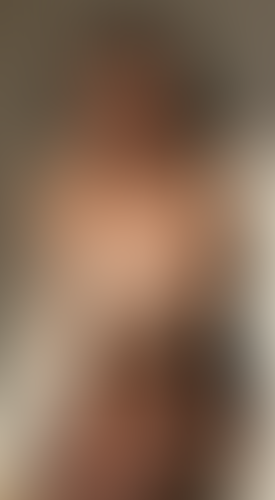 Geblurrte Content-Vorschau