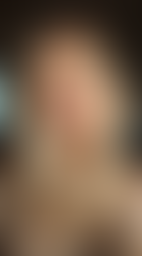 Geblurrte Content-Vorschau