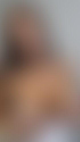 Geblurrte Content-Vorschau