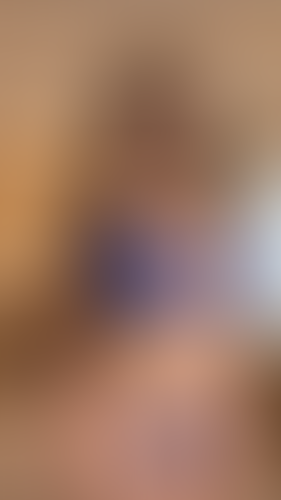 Geblurrte Content-Vorschau