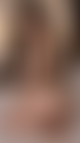 Geblurrte Content-Vorschau