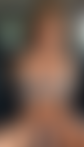 Geblurrte Content-Vorschau