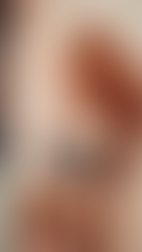 Geblurrte Content-Vorschau