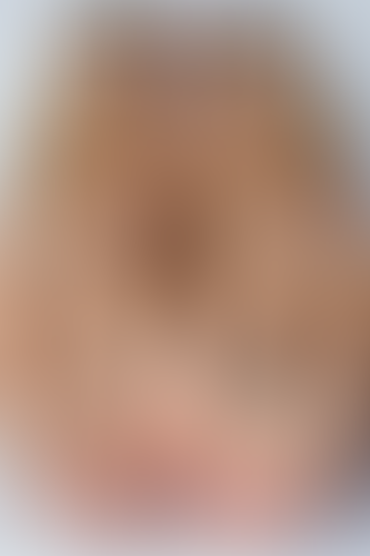 Geblurrte Content-Vorschau