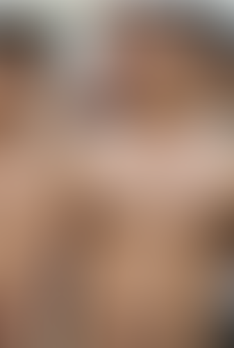 Geblurrte Content-Vorschau