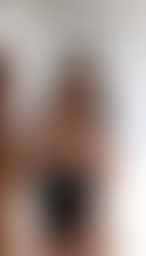 Geblurrte Content-Vorschau