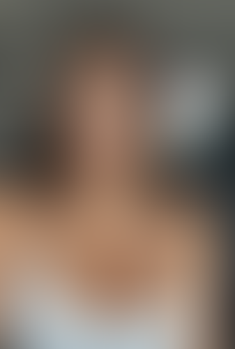 Geblurrte Content-Vorschau