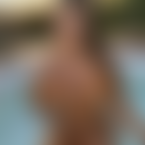 Geblurrte Content-Vorschau