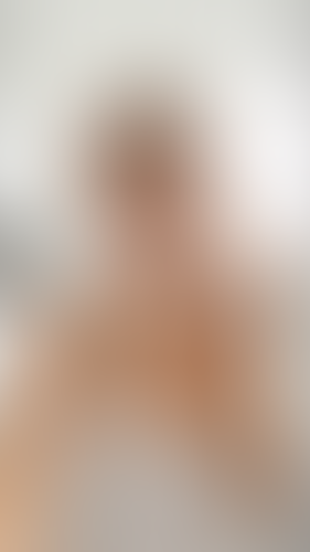 Geblurrte Content-Vorschau