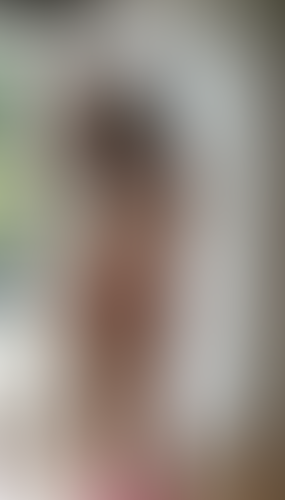 Geblurrte Content-Vorschau