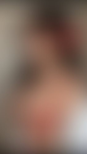 Geblurrte Content-Vorschau