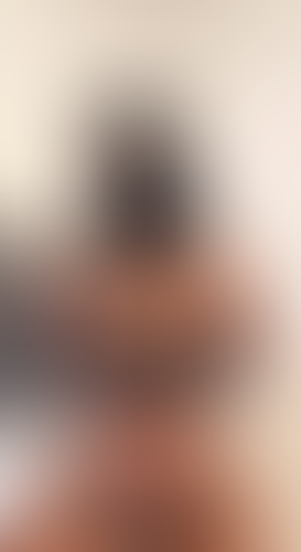 Geblurrte Content-Vorschau