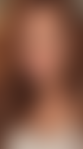 Geblurrte Content-Vorschau