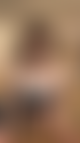Geblurrte Content-Vorschau