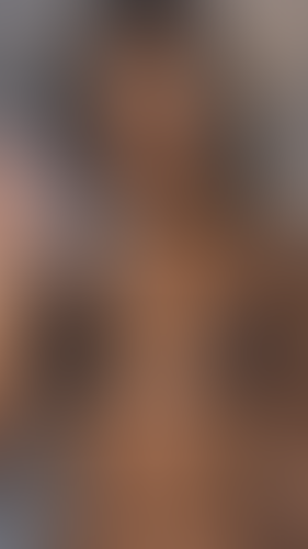 Geblurrte Content-Vorschau