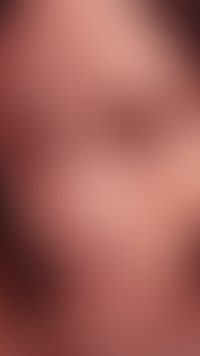 Geblurrte Content-Vorschau