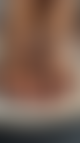 Geblurrte Content-Vorschau