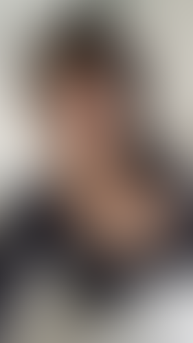 Geblurrte Content-Vorschau