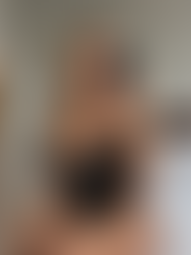 Geblurrte Content-Vorschau