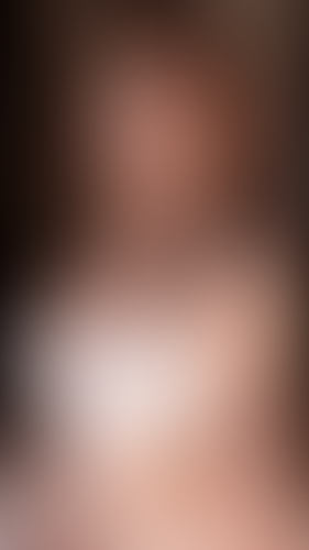 Geblurrte Content-Vorschau