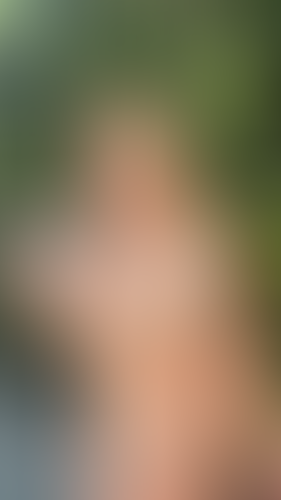 Geblurrte Content-Vorschau