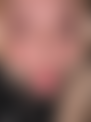 Geblurrte Content-Vorschau