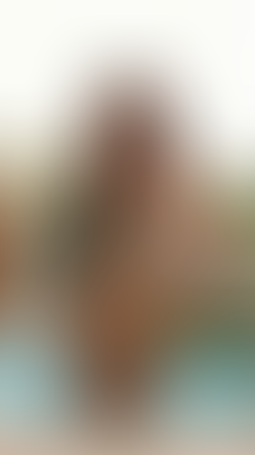 Geblurrte Content-Vorschau