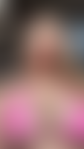 Geblurrte Content-Vorschau