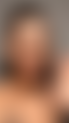 Geblurrte Content-Vorschau