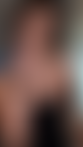 Geblurrte Content-Vorschau