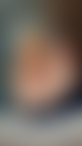 Geblurrte Content-Vorschau