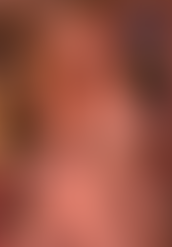 Geblurrte Content-Vorschau