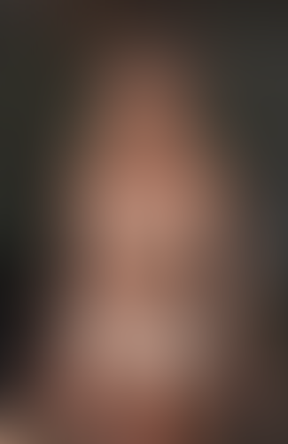 Geblurrte Content-Vorschau