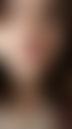 Geblurrte Content-Vorschau