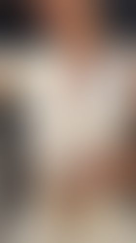 Geblurrte Content-Vorschau