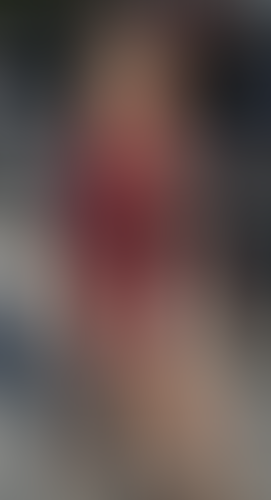 Geblurrte Content-Vorschau