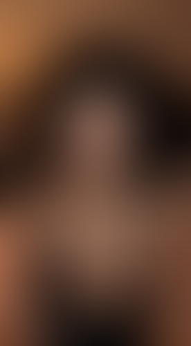 Geblurrte Content-Vorschau