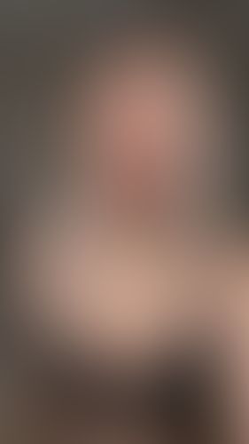 Geblurrte Content-Vorschau