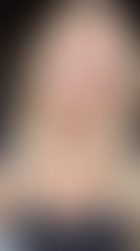 Geblurrte Content-Vorschau