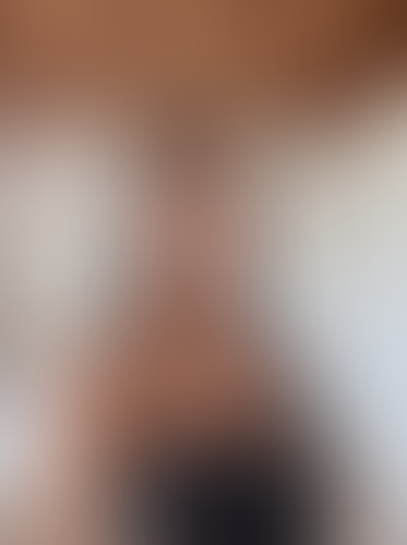 Geblurrte Content-Vorschau